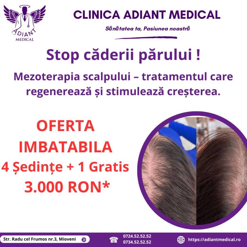 adiant mezoterapie