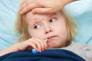 Cazurile de varicelă s-au înmulțit! Ce medicament trebuie evitat 17 varicela