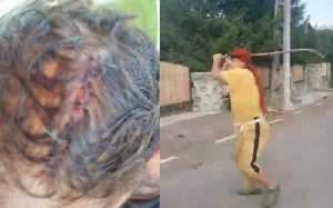 bascov agresat - ATENȚIE - Imagini cu impact emoțional! Un alt eveniment groaznic a avut loc în Bascov, la doar câteva zile după măcelul schizofrenicului!