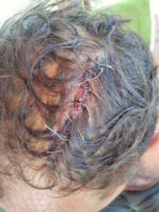 ATENȚIE - Imagini cu impact emoțional! Un alt eveniment groaznic a avut loc în Bascov, la doar câteva zile după măcelul schizofrenicului! 2 cap spart - ATENȚIE - Imagini cu impact emoțional! Un alt eveniment groaznic a avut loc în Bascov, la doar câteva zile după măcelul schizofrenicului!