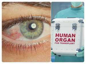 Clinică privată acuzată de trafic de organe! Aducea ilegal cornee din Italia 1 transplant ilegal cornee - Clinică privată acuzată de trafic de organe! Aducea ilegal cornee din Italia