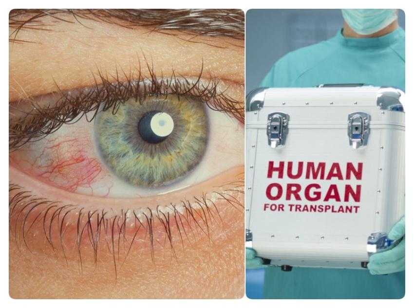 transplant-ilegal-cornee