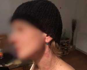 Pitești: Tânără sechestrată și bătută de propriul iubit 1 victima rapire ortiteag 01 - Pitești: Tânără sechestrată și bătută de propriul iubit