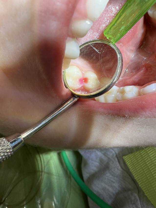 dr Teo pedodontie pedodont dr teo