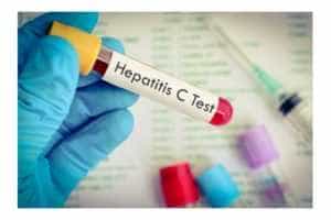 AZI! Testare GRATUITĂ pentru hepatitele virale B și C, la Pitești! 2 hepatita testare