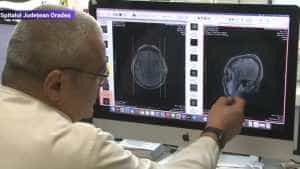 medic creier tumoare - Incredibil! Un bărbat de 66 de ani din Oradea a vorbit cu medicii, în timp ce era operat pe creier!