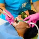 Clinica de medicină dentară Dr. TEO – Igienizarea dentară profesională 15 dentist stomatolog igienizare