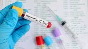 Județul Argeș, parte într-un important proiect de depistare precoce a virusului Hepatitei C 25 hepatita c diagnostic tratament Copy - Județul Argeș, parte într-un important proiect de depistare precoce a virusului Hepatitei C