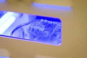 proteza cu capse 2 -  Avantajele protezelor dentare cu capse, pe implanturi