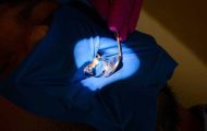 eroziunea dentara dr teo