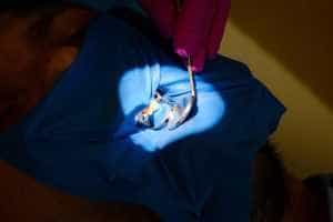 Clinica Dr. TEO – Eroziunea dentară 1 eroziunea dentara Dr Teo