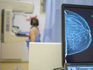 Prin proiectul cu Banca Mondială. Ministrul Sănătății achiziționează mamografe 1 Sursă foto: providentamedical.ro.
