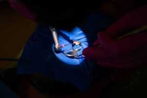 coronele dentare dr Teo