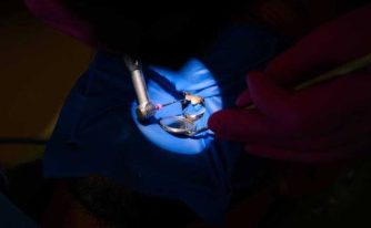 coronele dentare dr Teo