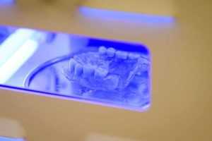 Clinica de medicină dentară DR TEO – Protezele dentare cu capse pe implanturi 1 proteza cu capse Dr Teo