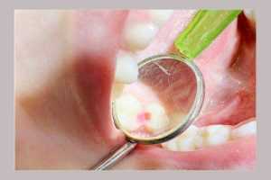 Clinica de medicină dentară DR TEO – PEDODONȚIA 1 Dr Teo