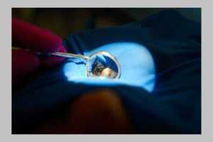 Clinica de medicină dentară DR TEO – MĂSEAUA DE MINTE 1 dr Teo maseaua de minte