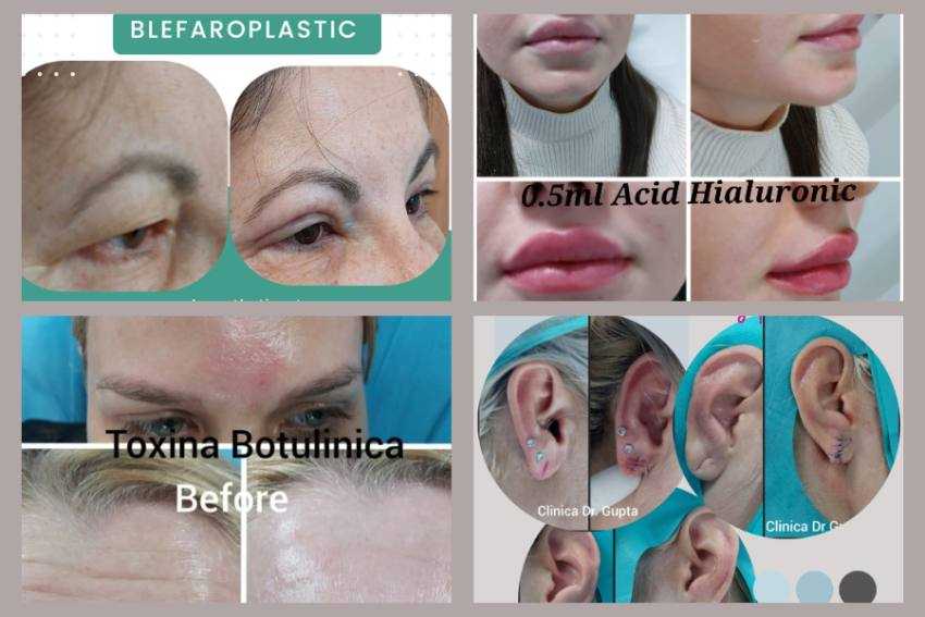 Clinica Dr Gupta LUY ESTHETIC ART