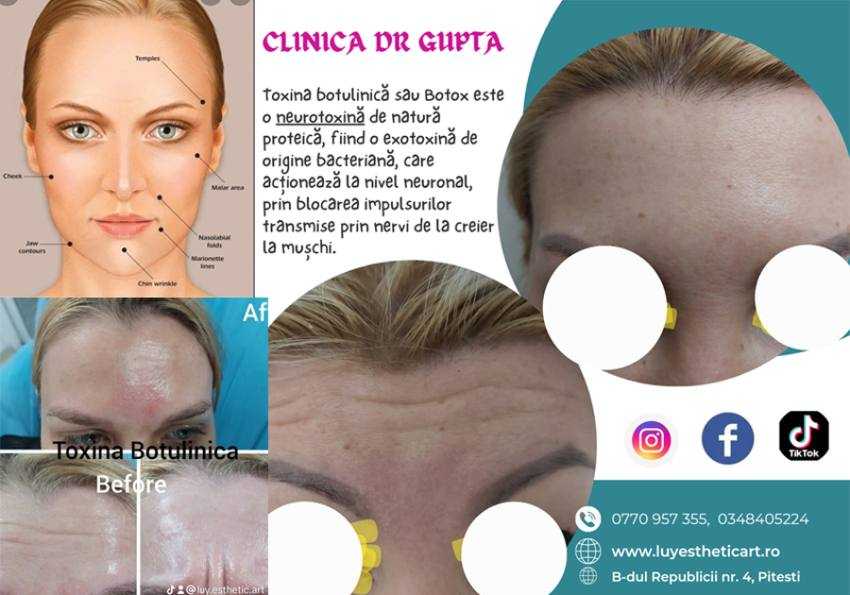 Sursă foto: Facebook Luy Esthetic Art.