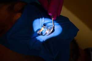 eroziunea dentara Dr. Teo