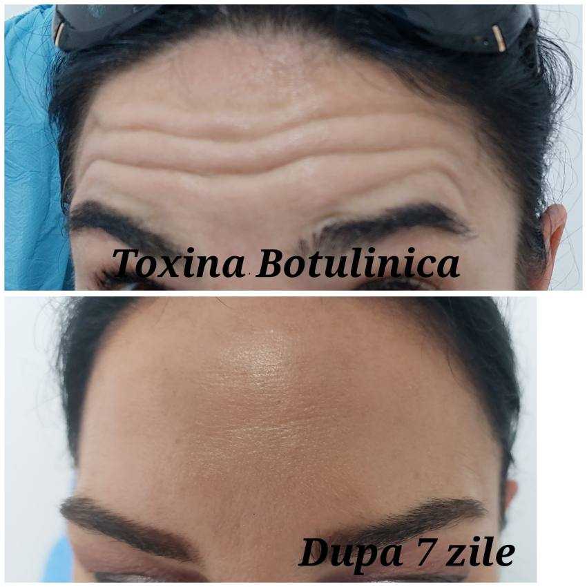 Dr. Gupta by Luy Estetic botox