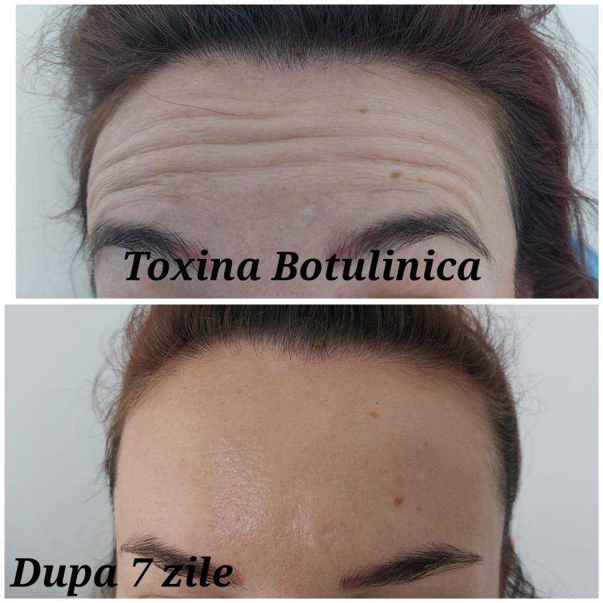Dr. Gupta by Luy Estetic botox