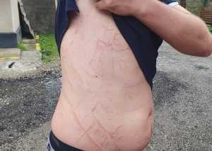 456449005 894705762684293 2891324111637973778 n - Așa arată un om lovit de fulger în munții Argeșului!