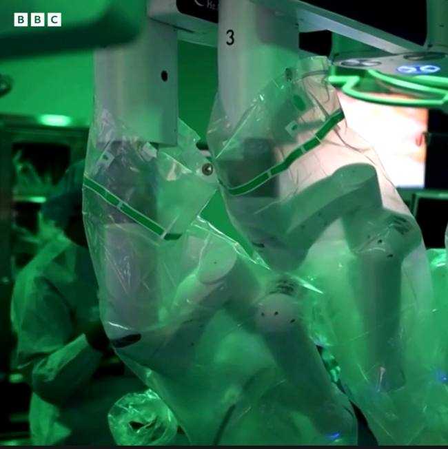 primul transplant dublu de plămâni 