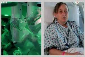 primul transplant dublu de plămâni realizat integral robotic