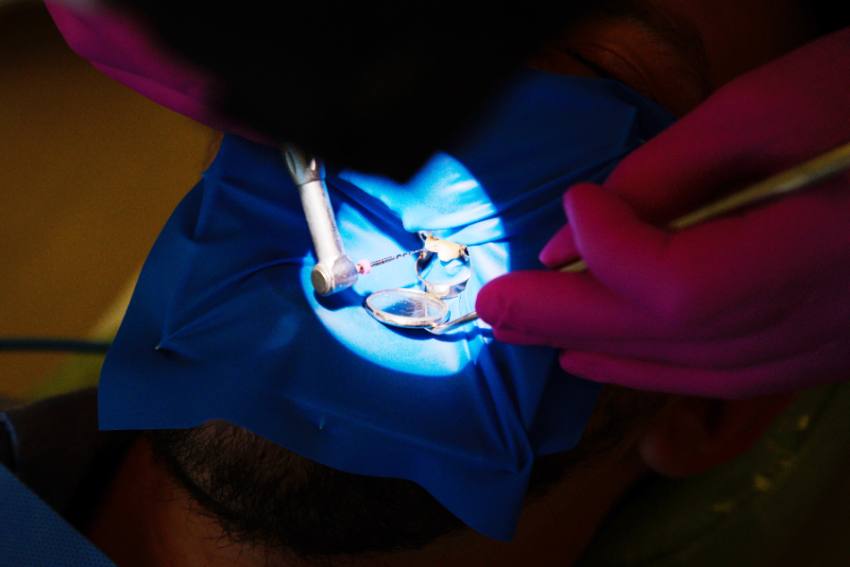 coroanele dentare Dr Teo