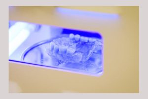 Clinica de medicină dentară DR TEO – Protezele dentare cu capse pe implanturi 1 Dr Teo