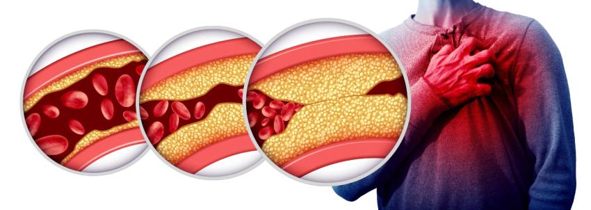Dr. Adrian Tase: „Bolile de inimă reprezintă o adevărată epidemie” 2 afectiuni de inima - Dr. Adrian Tase: „Bolile de inimă reprezintă o adevărată epidemie”