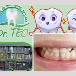 sigilarea la copii dr Teo