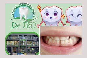 sigilarea la copii dr Teo