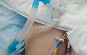 pacienta 3 1536x600 1 - O femeie a murit după ce i s-a administrat un antibiotic la care era alergică