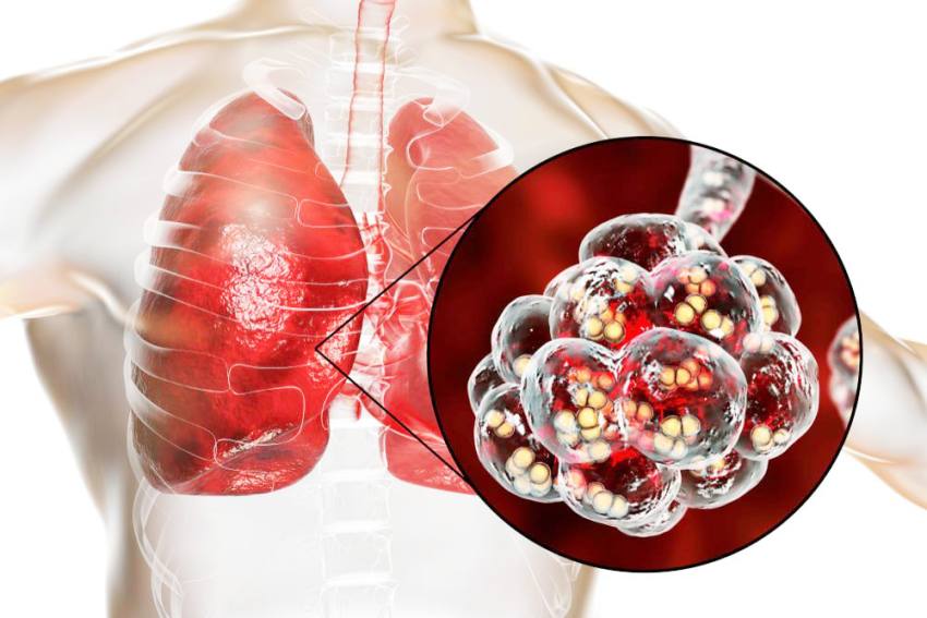 Numărul copiilor vaccinați în Argeș a scăzut cu 20.696 în ultimii ani 3 caseta 2 - Numărul copiilor vaccinați în Argeș a scăzut cu 20.696 în ultimii ani