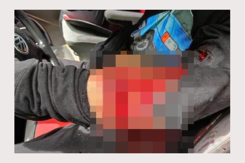 (Video) ARGEȘ. Trei oameni au ajuns de ieri și până astăzi la spital mușcați de urși 1 barbat muscat de urs