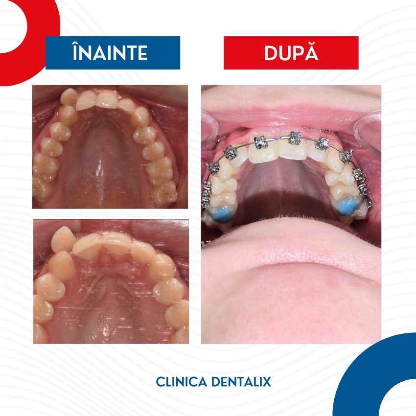 Dentalix Ortodontie - DENTALIX – Unde zâmbetul tău prinde viață!