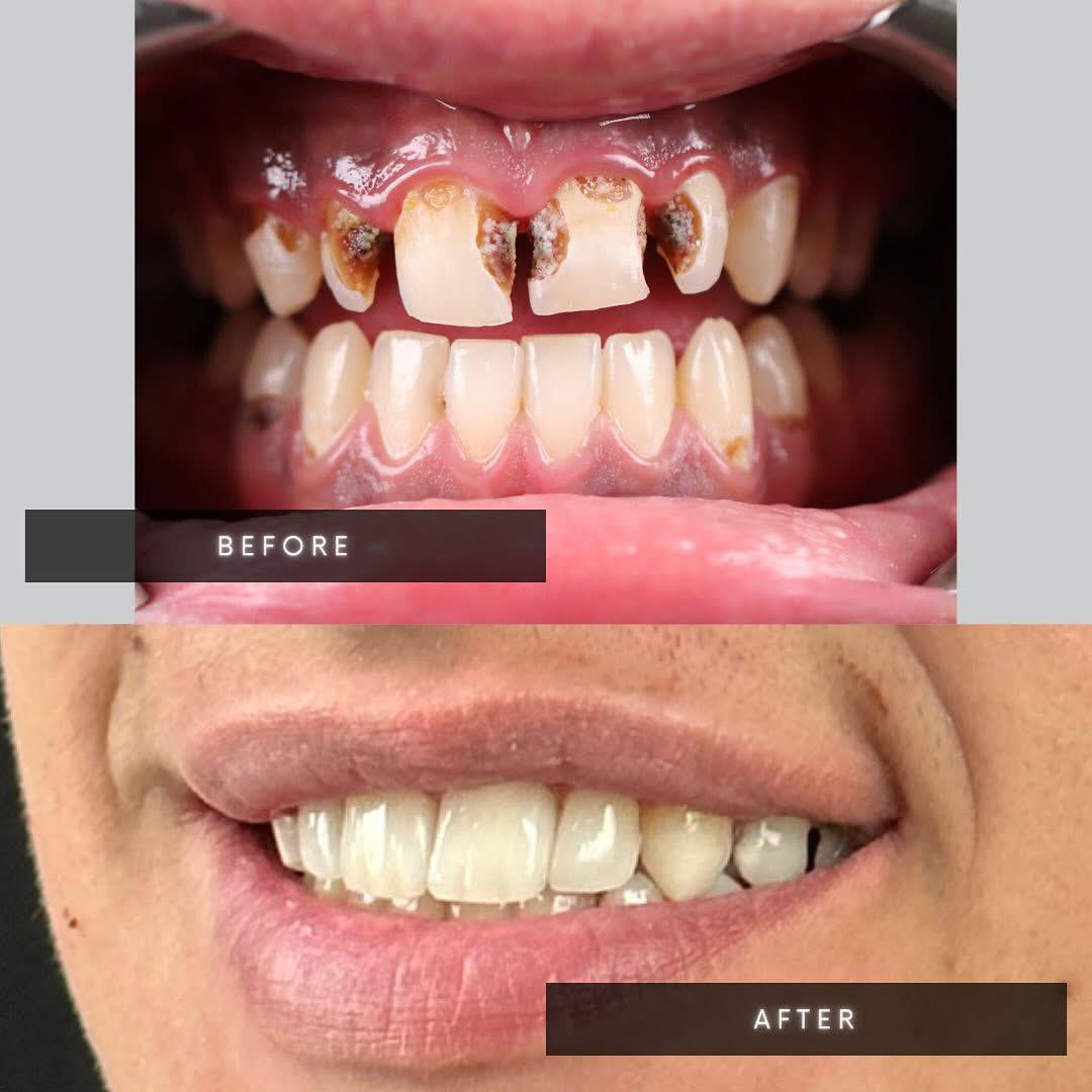 WhatsApp Image 2025 05 28 at 11.28.20 - DENTALIX – Unde zâmbetul tău prinde viață!