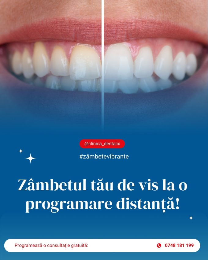 - DENTALIX – Unde zâmbetul tău prinde viață!
