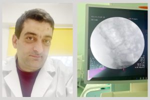 Nou! Infiltrații periradiculare ghidate radiologic efectuate la Spitalul Județean Pitești 20 SJU infiltratii