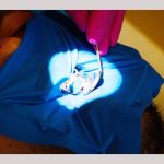 Clinica de medicină dentară Dr. Teo – EROZIUNEA DENTARĂ 14 Dr Teo eroziunea dentara