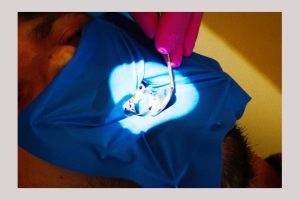 Clinica de medicină dentară Dr. Teo – EROZIUNEA DENTARĂ 1 Dr Teo eroziunea dentara