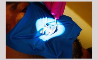Dr Teo eroziunea dentara