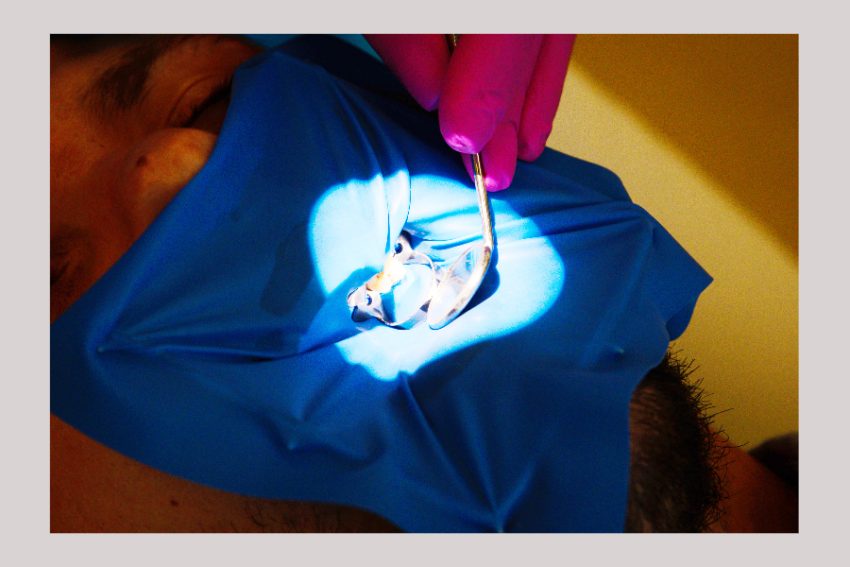 Dr Teo eroziunea dentara Dr Teo eroziunea dentara