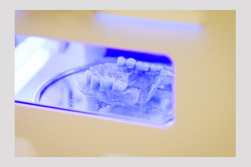 dr Teo Protezele dentare cu capse pe implanturi