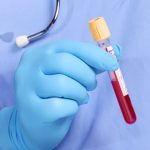 Analize medicale gratuite, la Spitalul Judeţean de Urgenţă Piteşti 11 analize-medicale