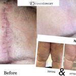 40% reducere într-o singură seară! Tratamente premium și tehnologii revoluționare la Zinart Clinique 11 Sursă foto: Zinart Clinique.