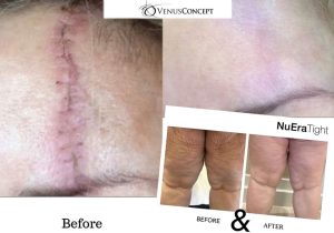 Sursă foto: Zinart Clinique.