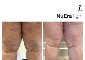 Sursă foto: Zinart Clinique.